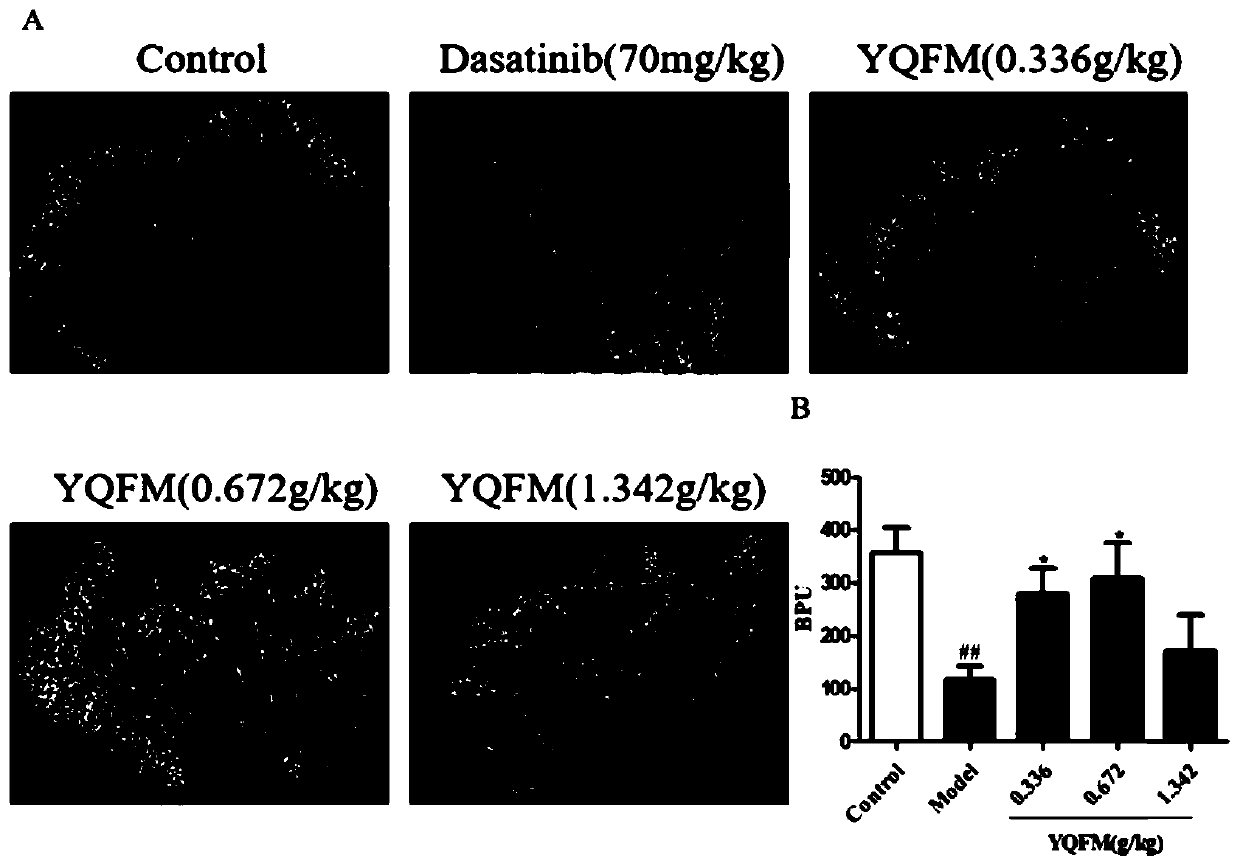 Application of qi-tonifying and pulse-restoring (freeze-drying) or ruscogenin for injection in prevention of pharmaceutical organ hemorrhage