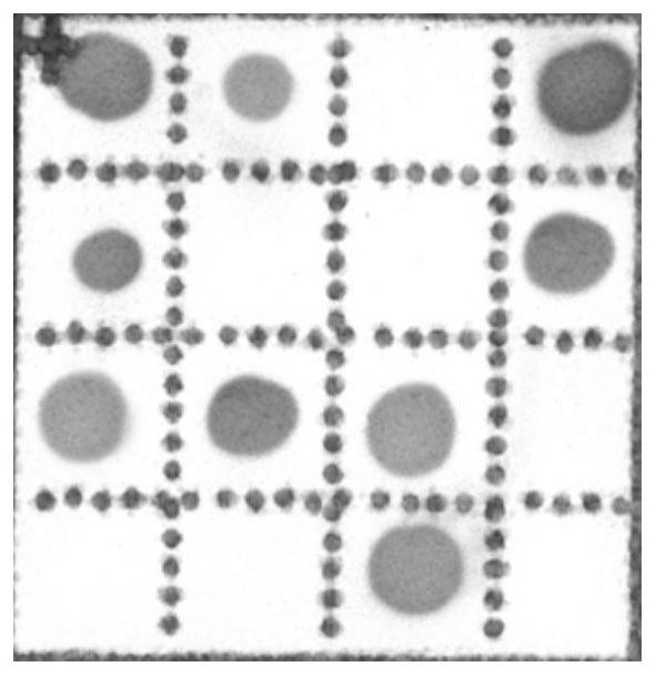 A nucleic acid combination and application thereof for detection of pathogenic vibrio