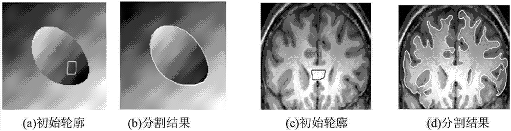 Narrowband constraint-based local segmentation method for geometric activity contour model image