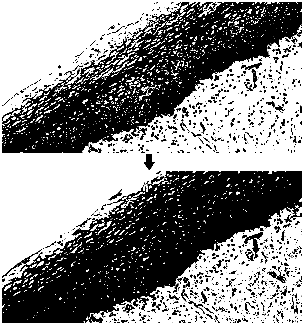 Automatic pathological image labeling method based on reinforcement learning and deep neural network