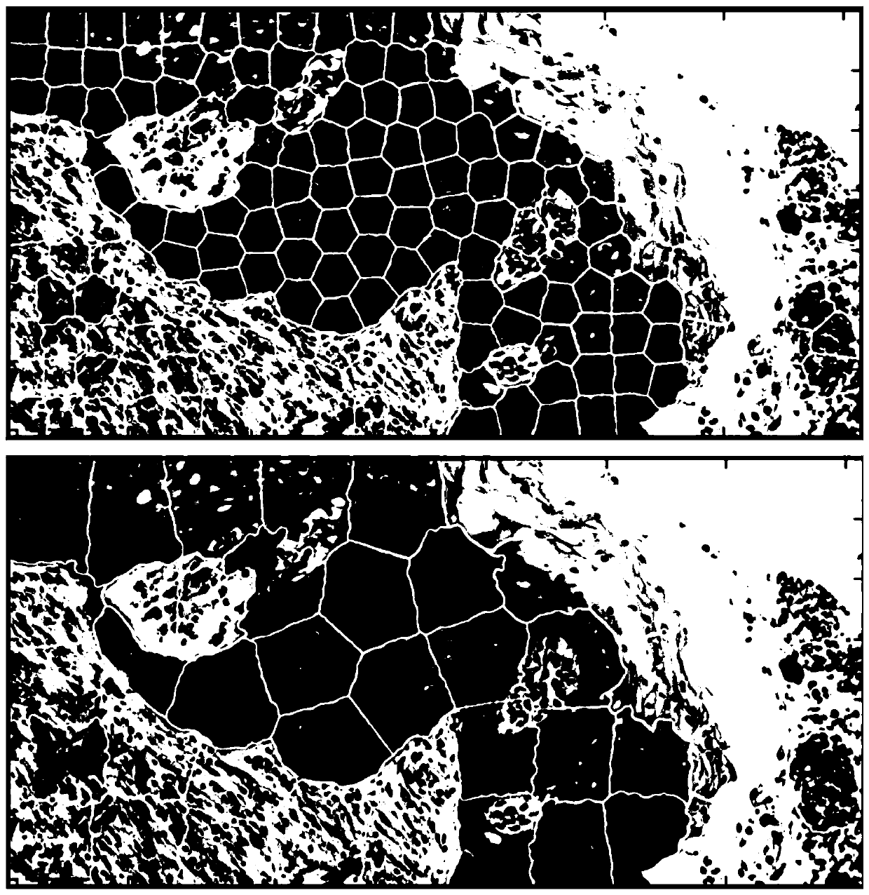 Automatic pathological image labeling method based on reinforcement learning and deep neural network