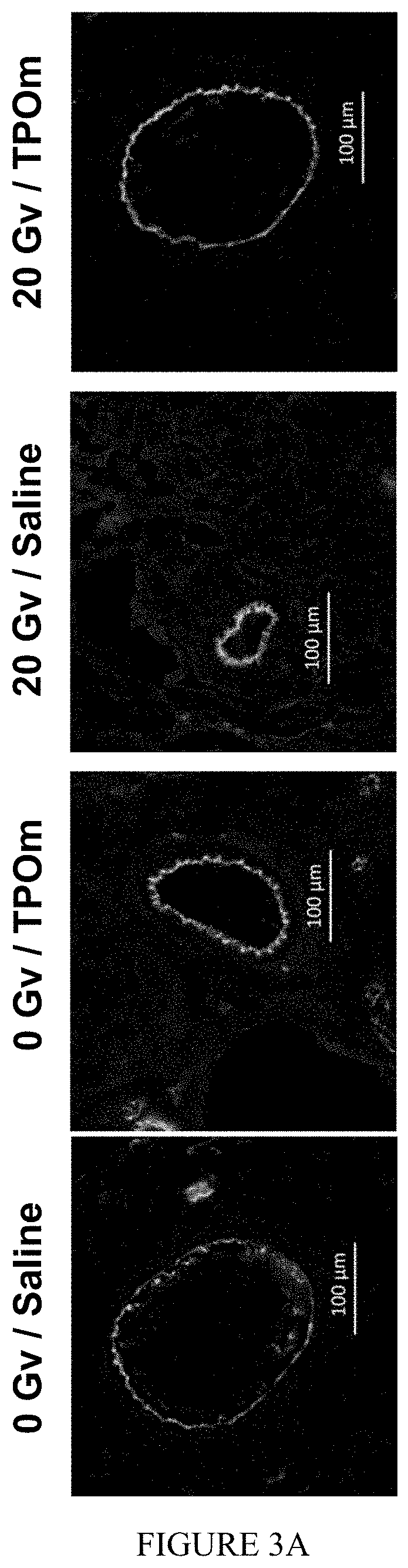 Methods of protecting vascular integrity induced by targeted radiation therapy