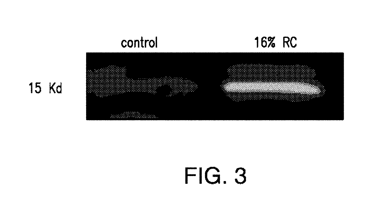 Compositions and methods for reducing the risk of radiocontrast-induced nephropathy