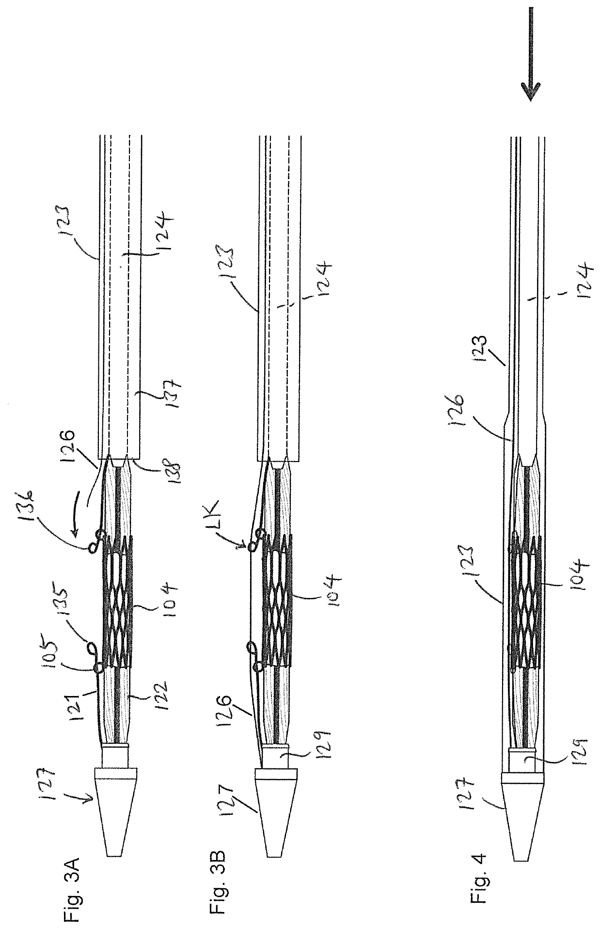 Method and Assembly for Securing an Implantable Medical Device on a Delivery System