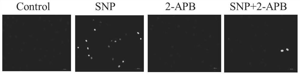 Application of 2-apb in preparation of medicine for treating osteoarthritis