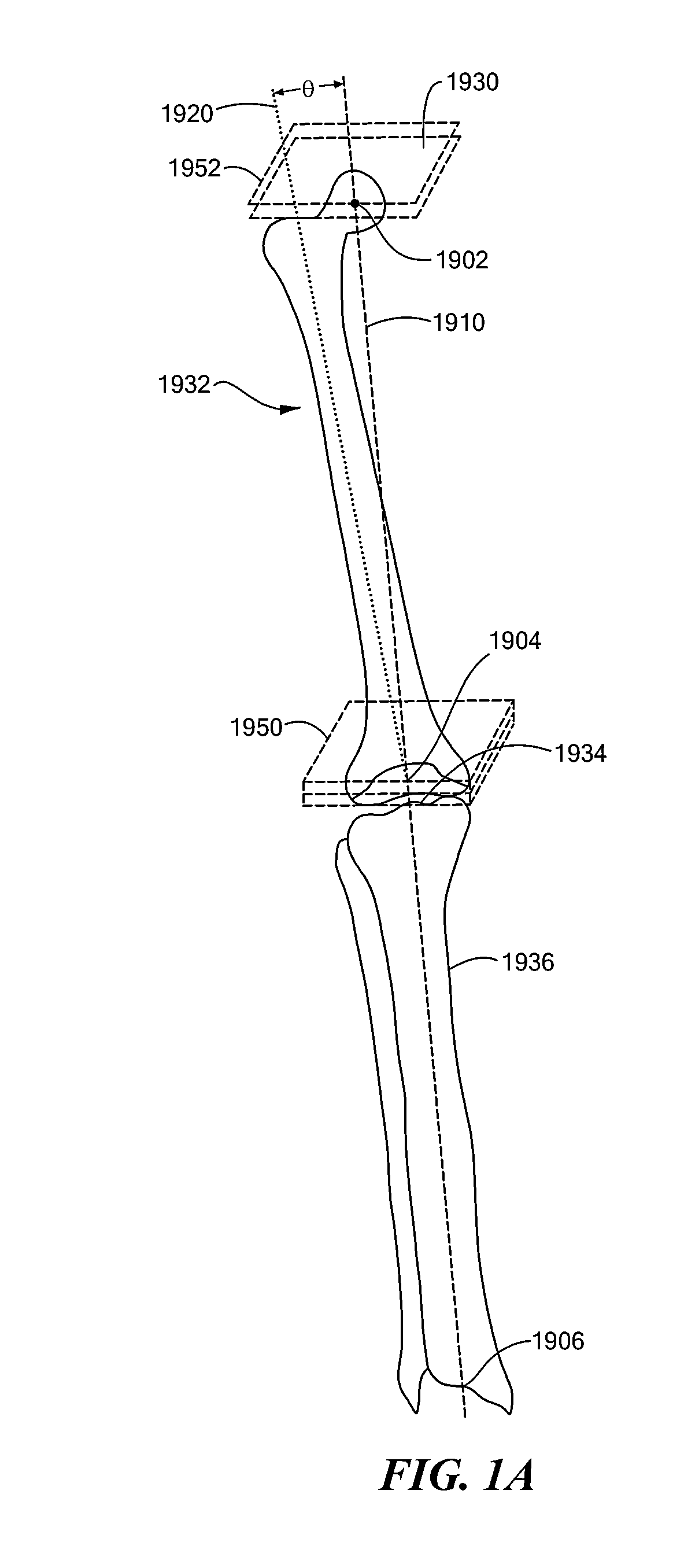 Patient Selectable Joint Arthroplasty Devices and Surgical Tools