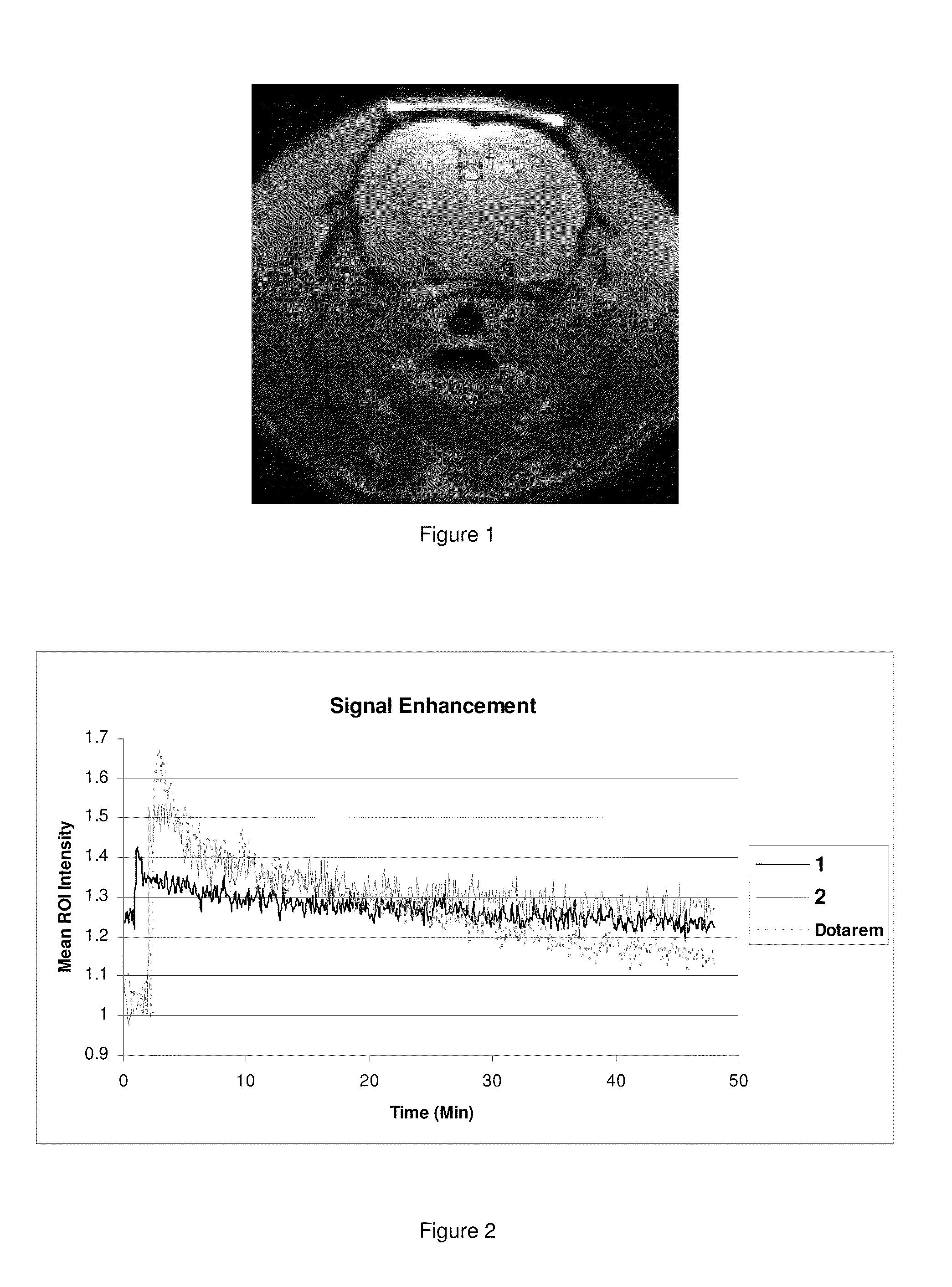 Intravascular contrast agents