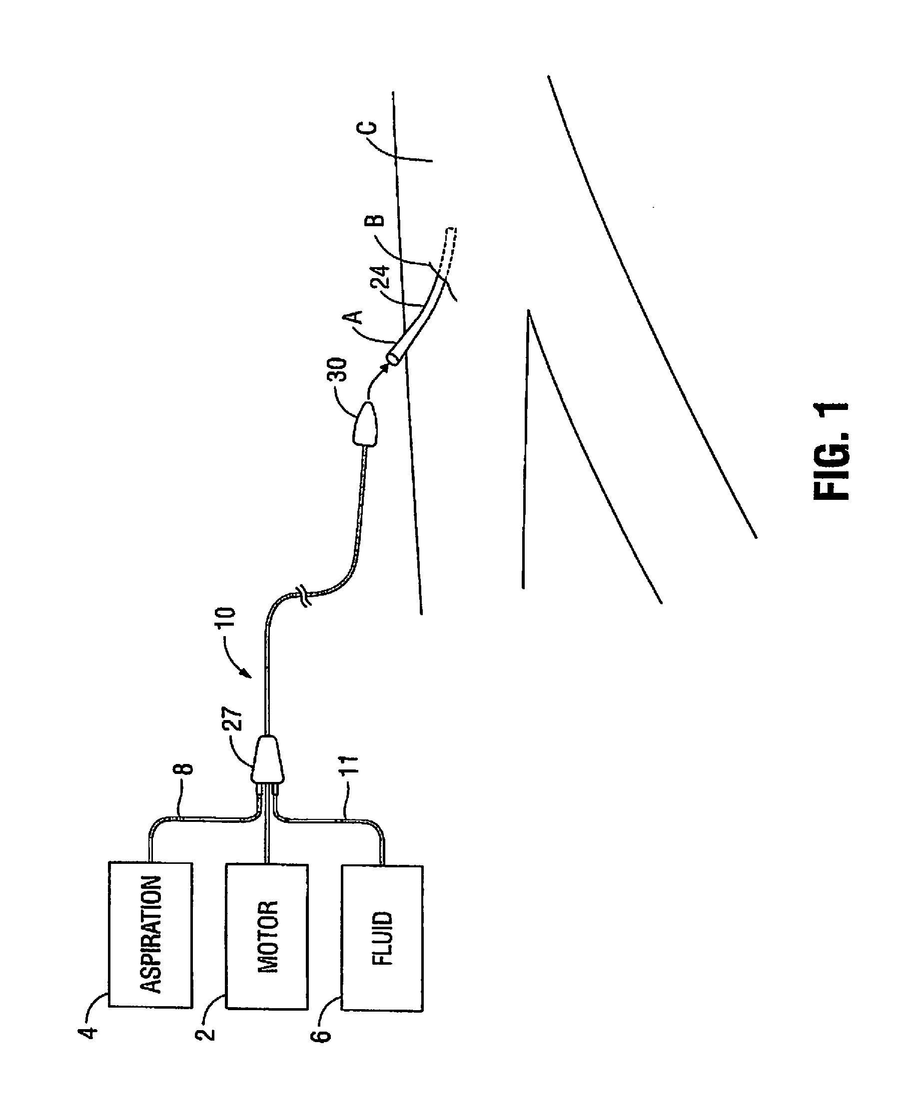 Atherectomy device