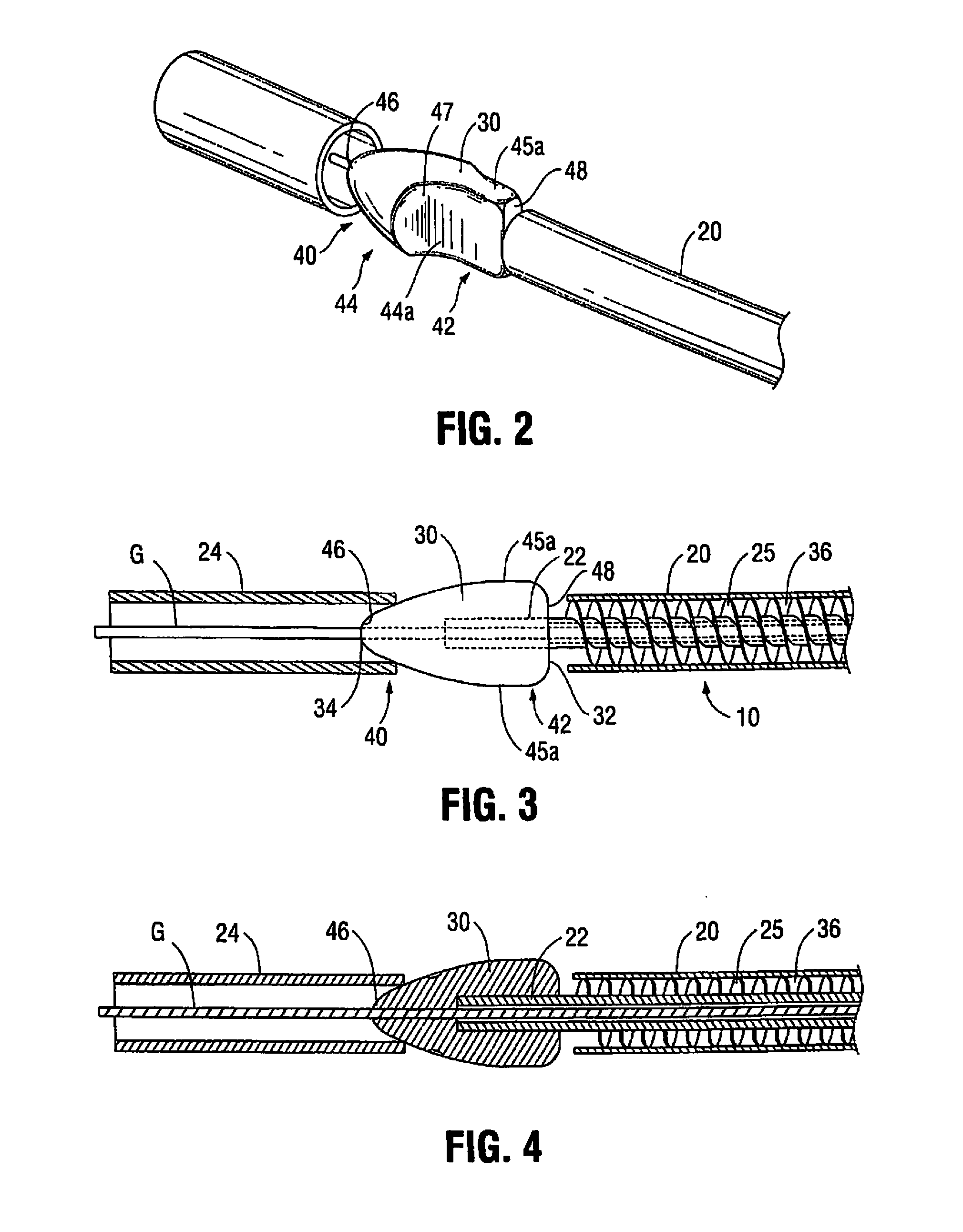 Atherectomy device