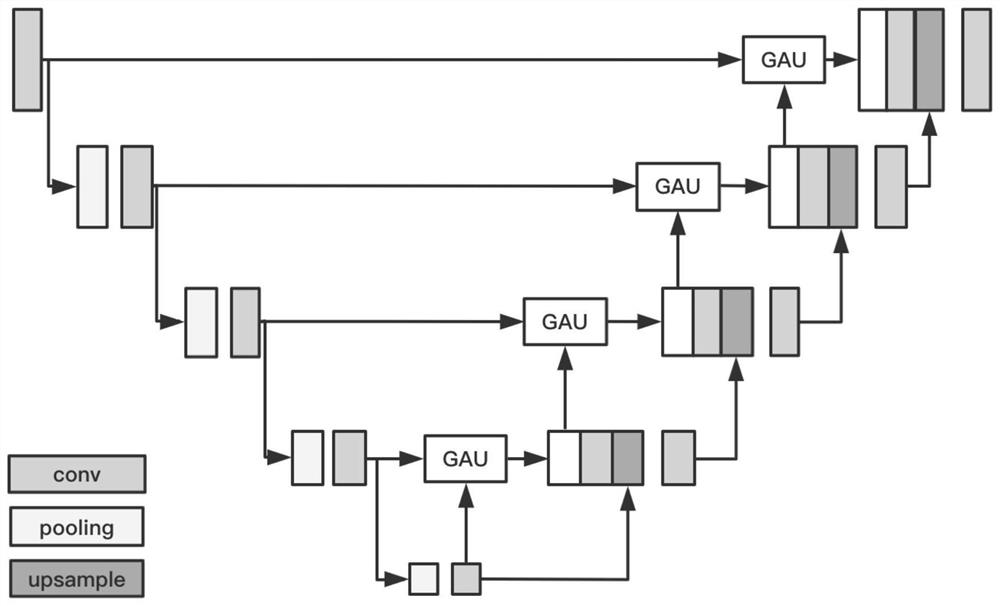 Liver CT image multi-lesion classification method based on sample generation and transfer learning