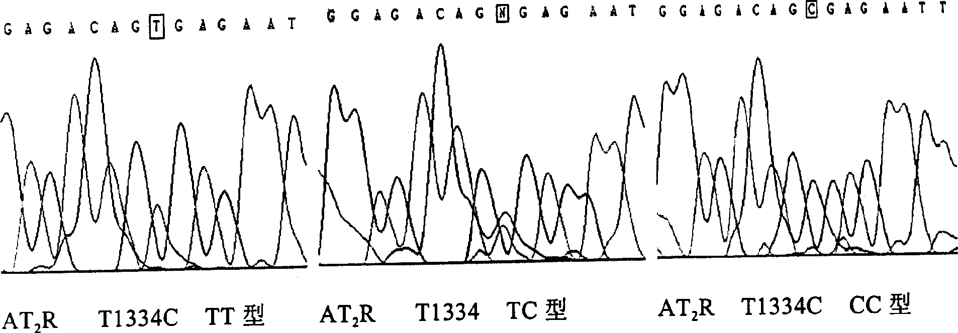 Angiotensin II-2 type receptor gene and its correlation of essential hypertension