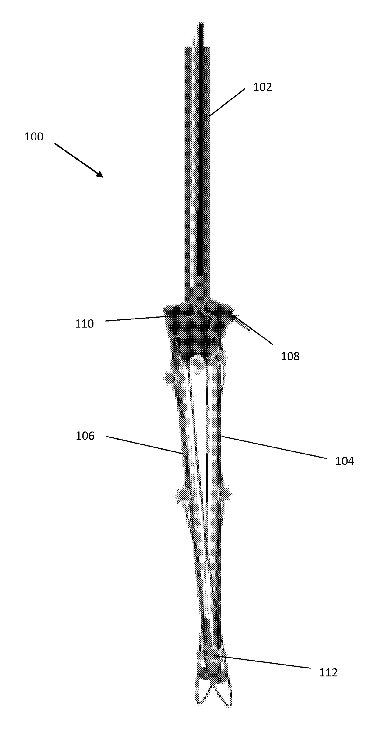 Endoscopic gastric mucosal ablation/resection/exclusion (a/r/e) as a minimally invasive weight loss approach