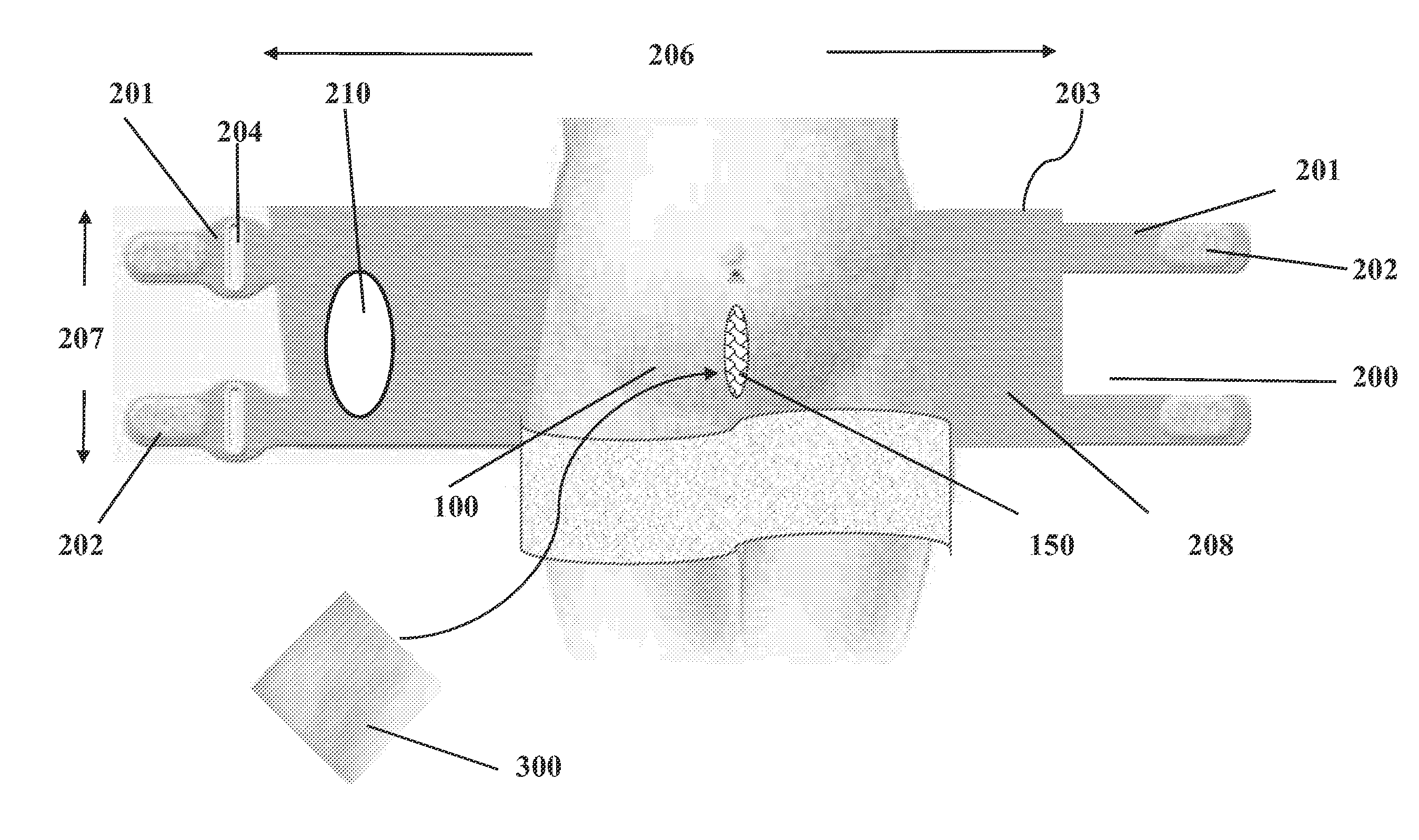 Hemostasis wound healing device for dynamic elastic injury site