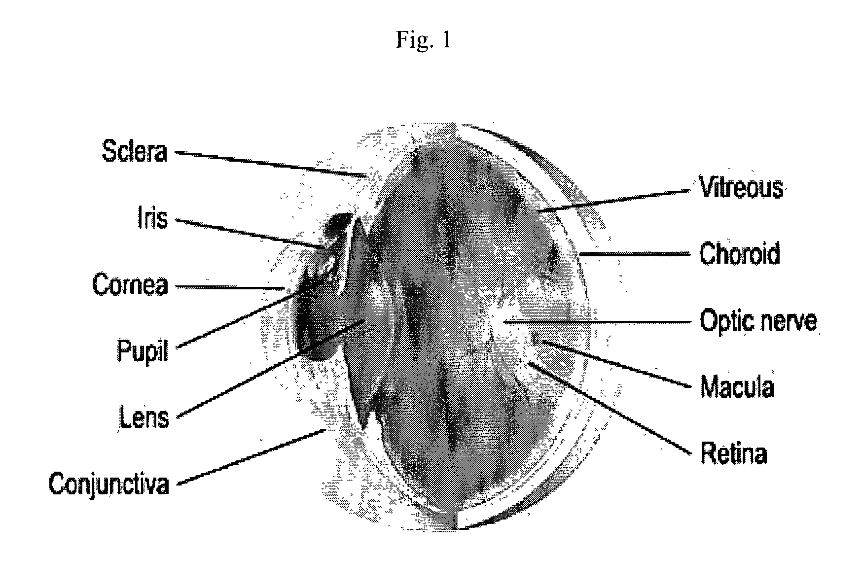 Treatment of ophthalmic conditions