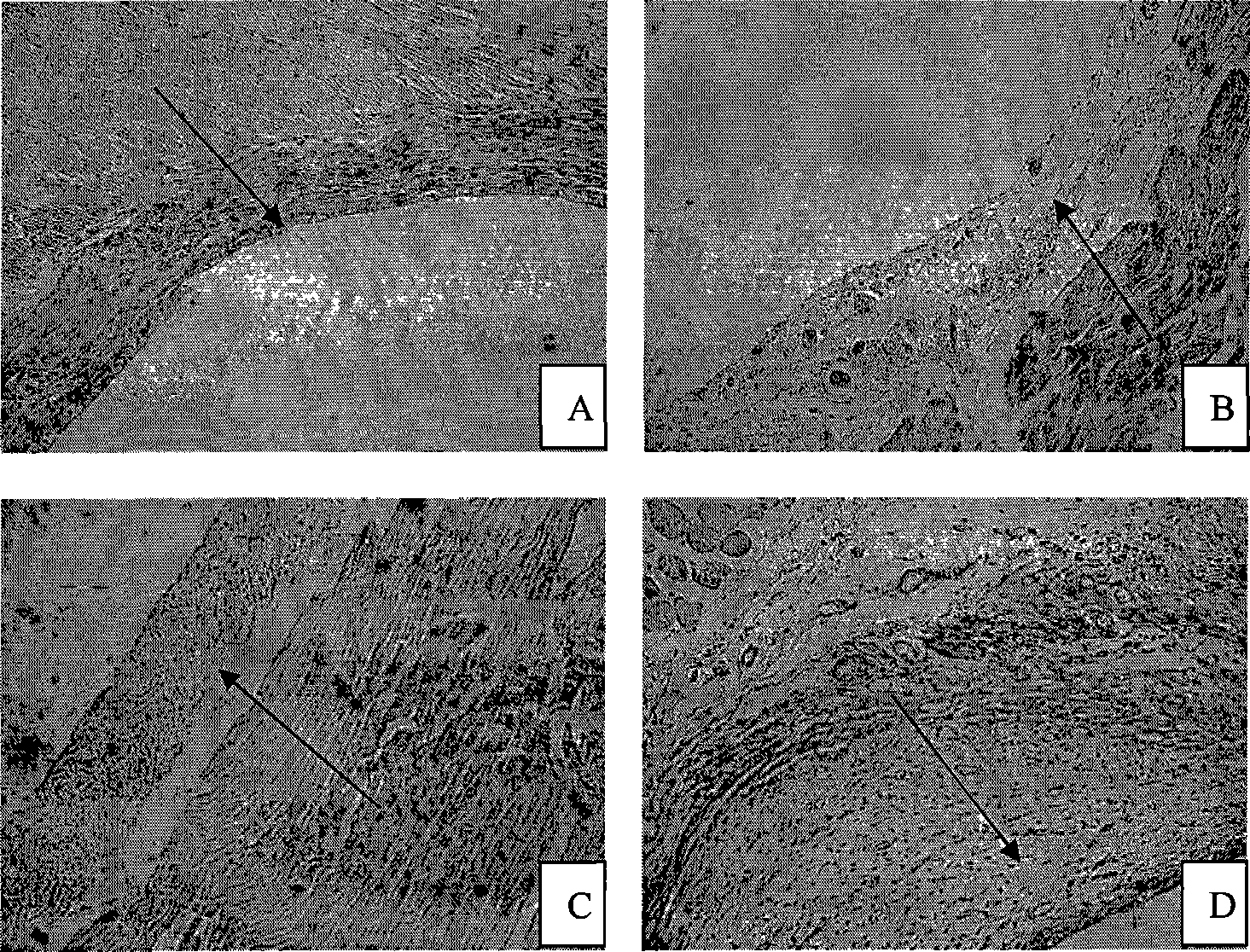 Pharmaceutical formulation for treating endometriosis symptom and processes for their preparation