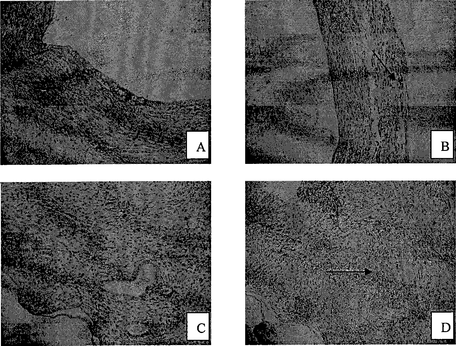 Pharmaceutical formulation for treating endometriosis symptom and processes for their preparation