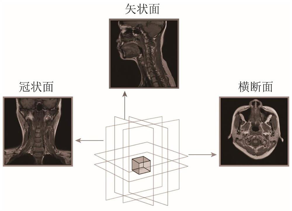 Head three-dimensional MRI super-resolution reconstruction method