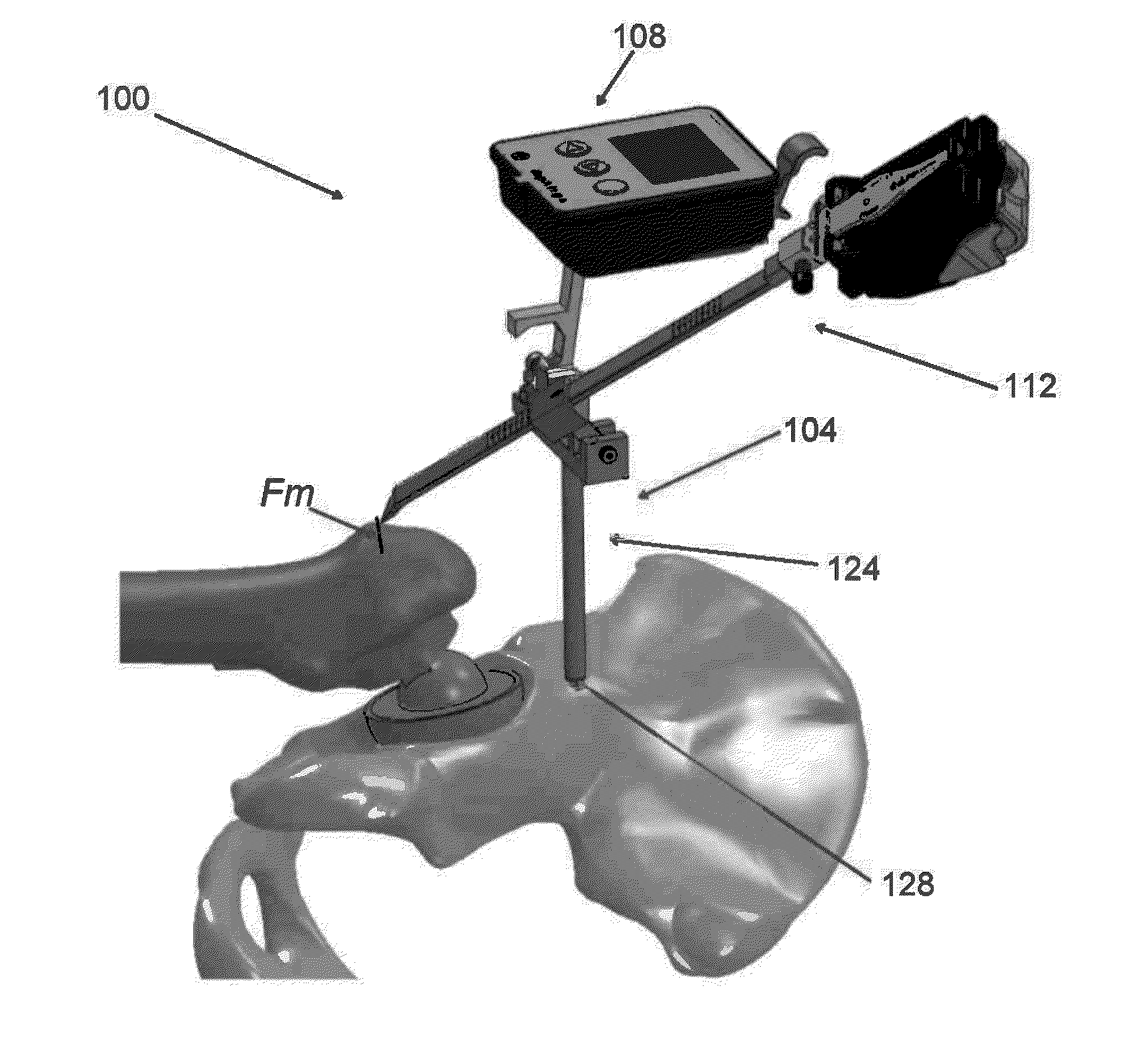 Hip replacement navigation system and method