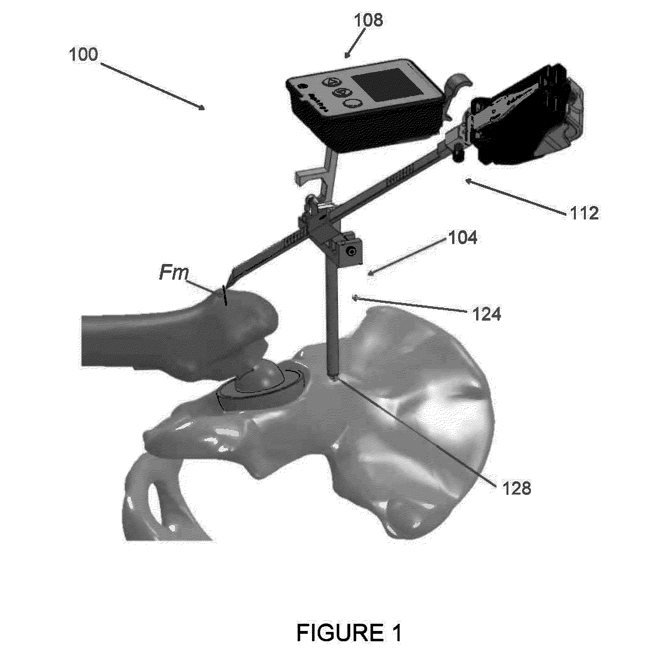 Hip replacement navigation system and method