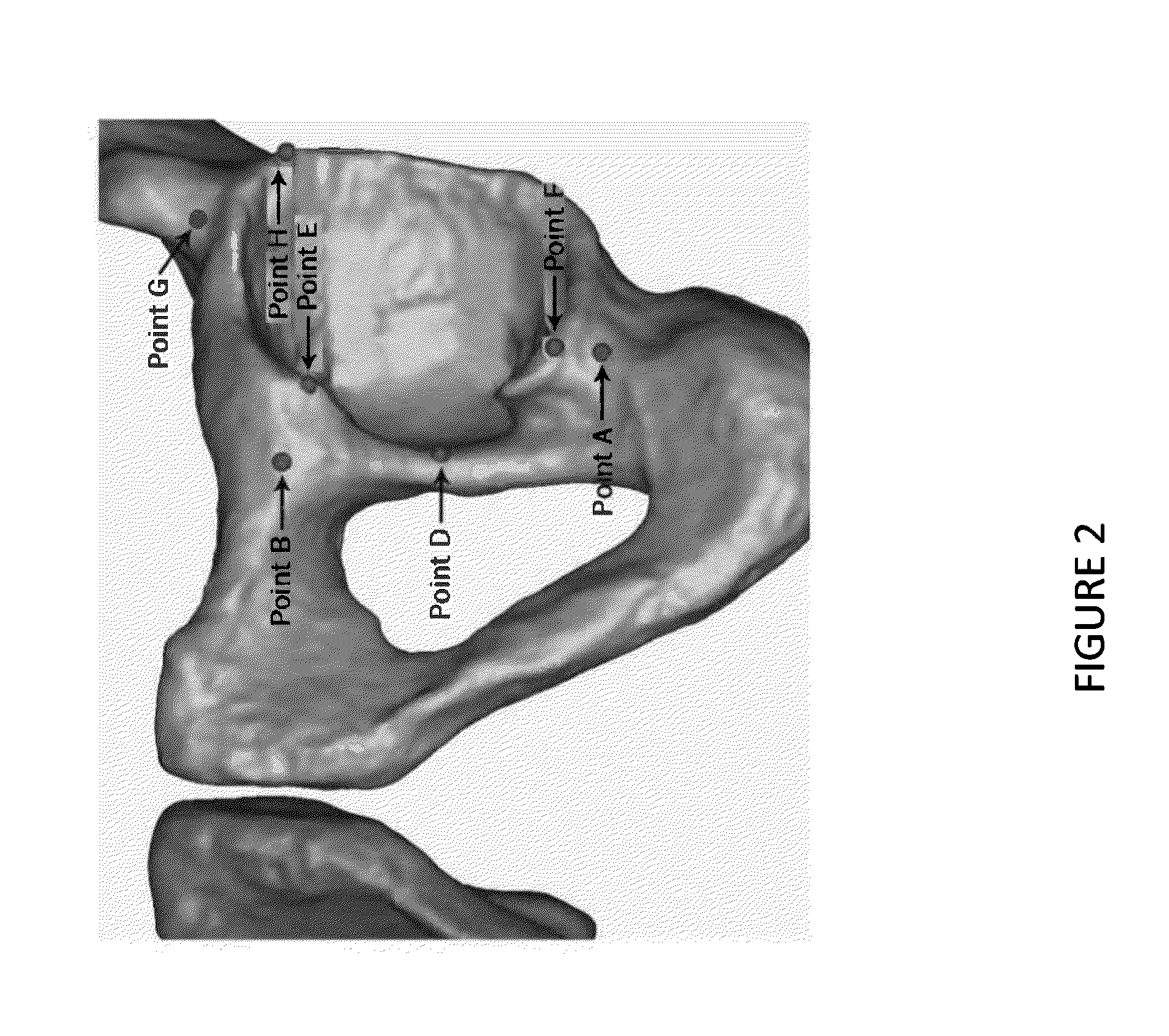 Hip replacement navigation system and method