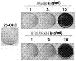 Cholesterol molecular probe as well as preparation method and application thereof