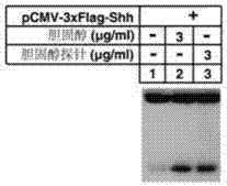 Cholesterol molecular probe as well as preparation method and application thereof