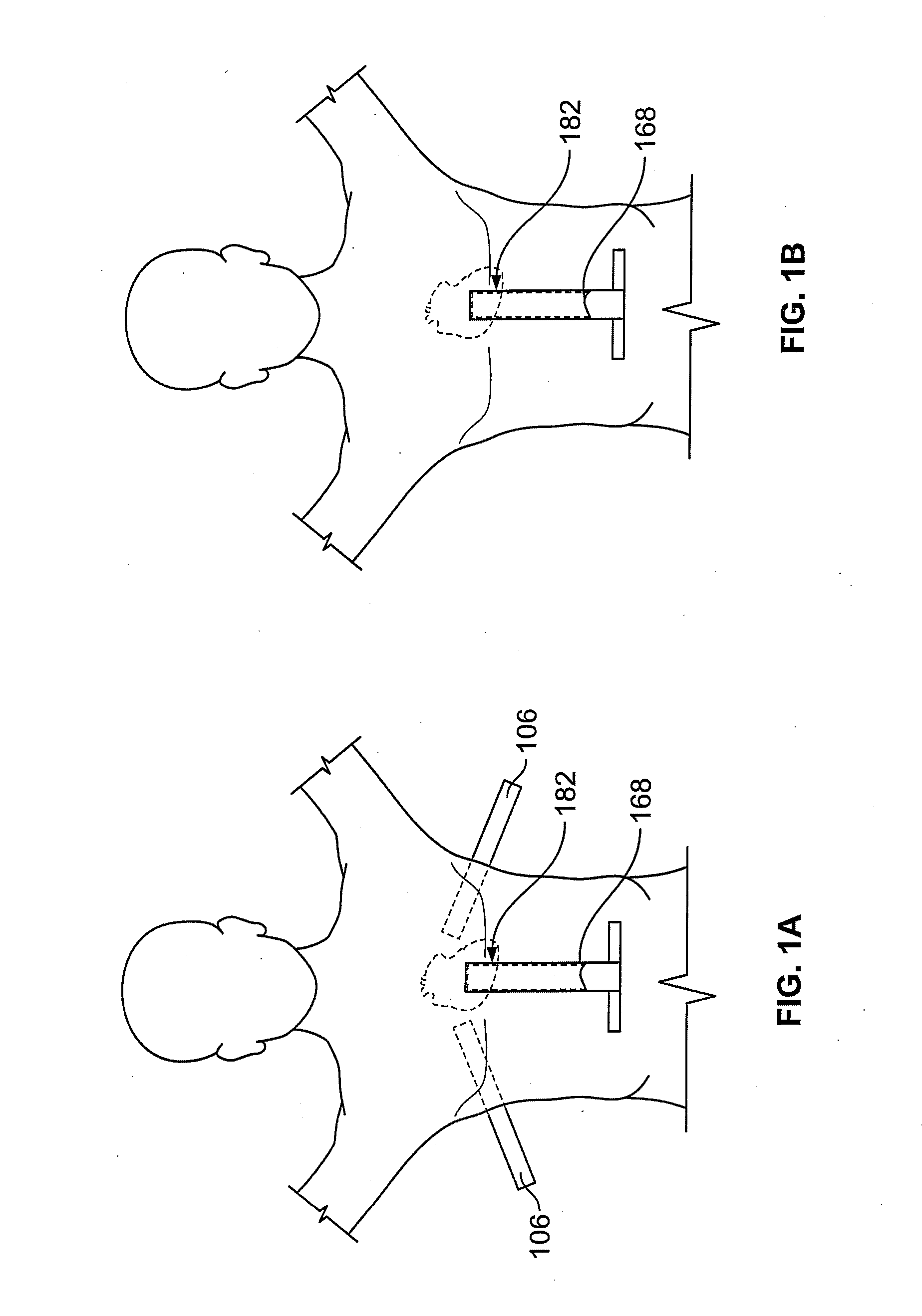 Diaphragm entry for posterior surgical access