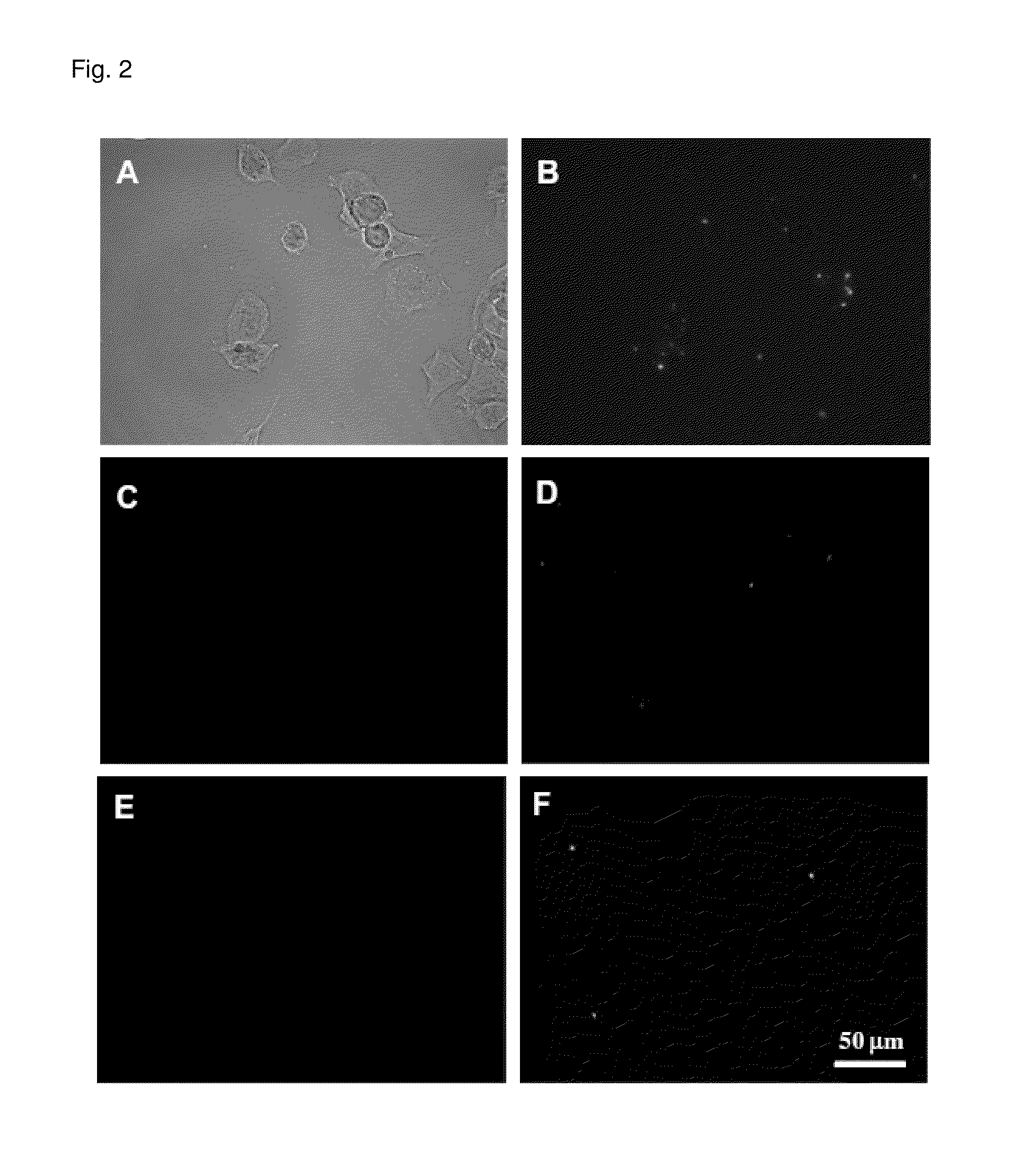 Method for detecting amyloid aggregates using styrylpyridazine-one derivatives