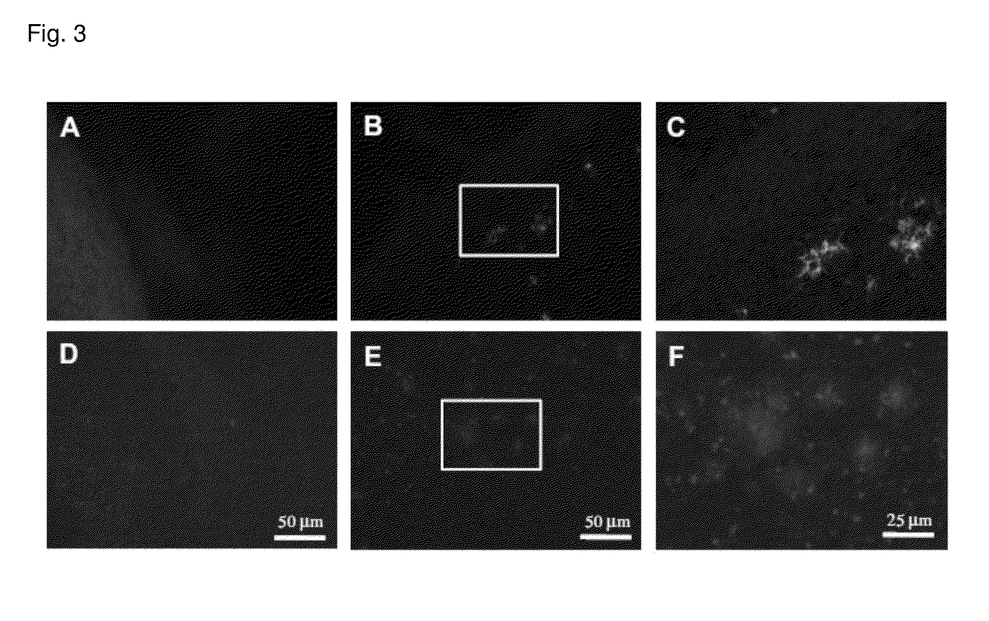 Method for detecting amyloid aggregates using styrylpyridazine-one derivatives