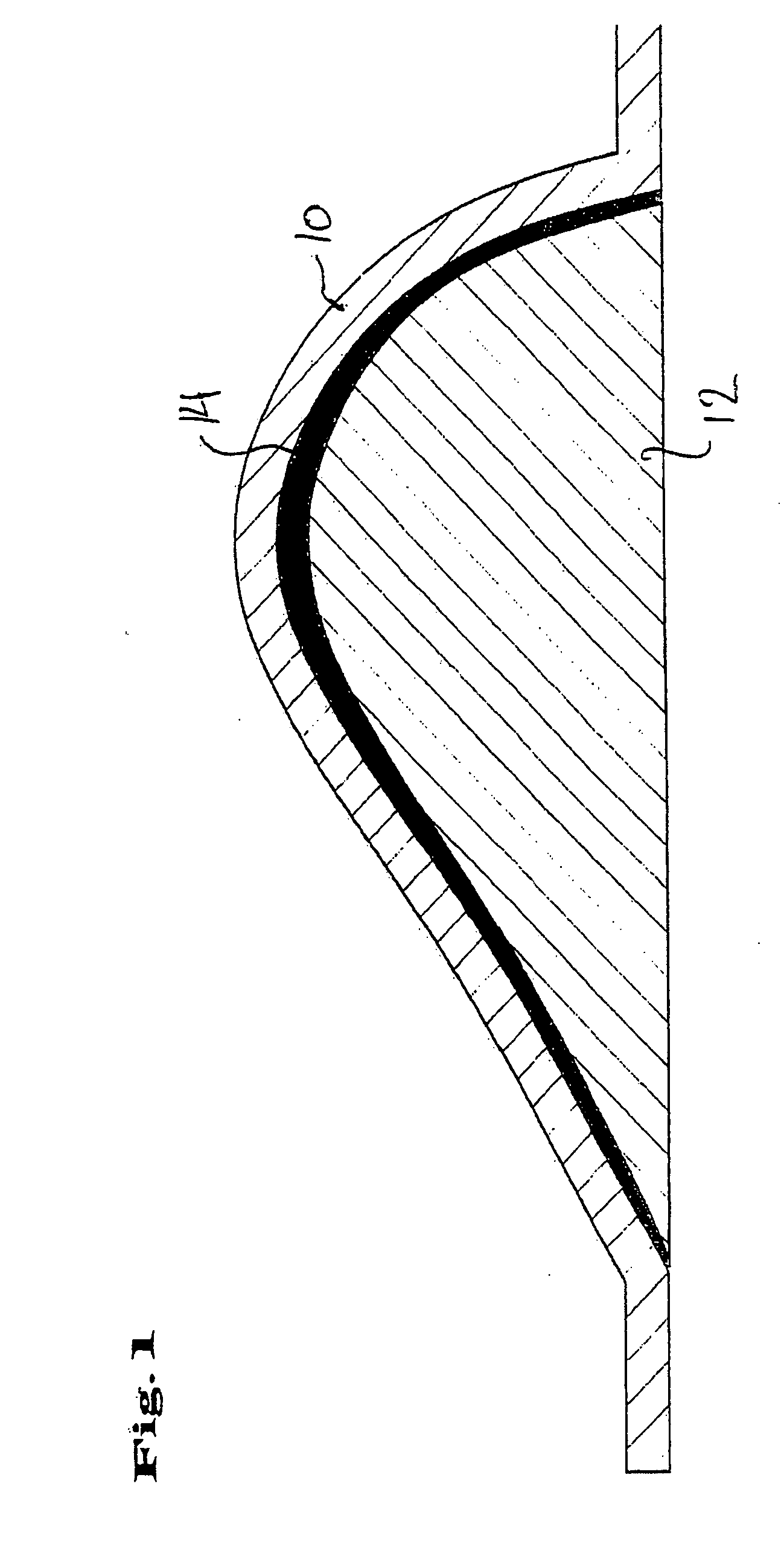 Method of manufacturing a breast prosthesis