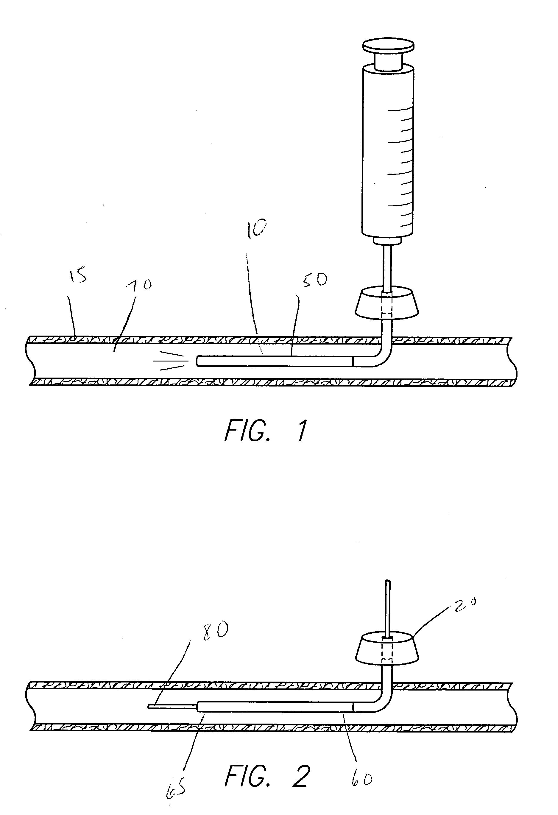 Implantable intravascular delivery device