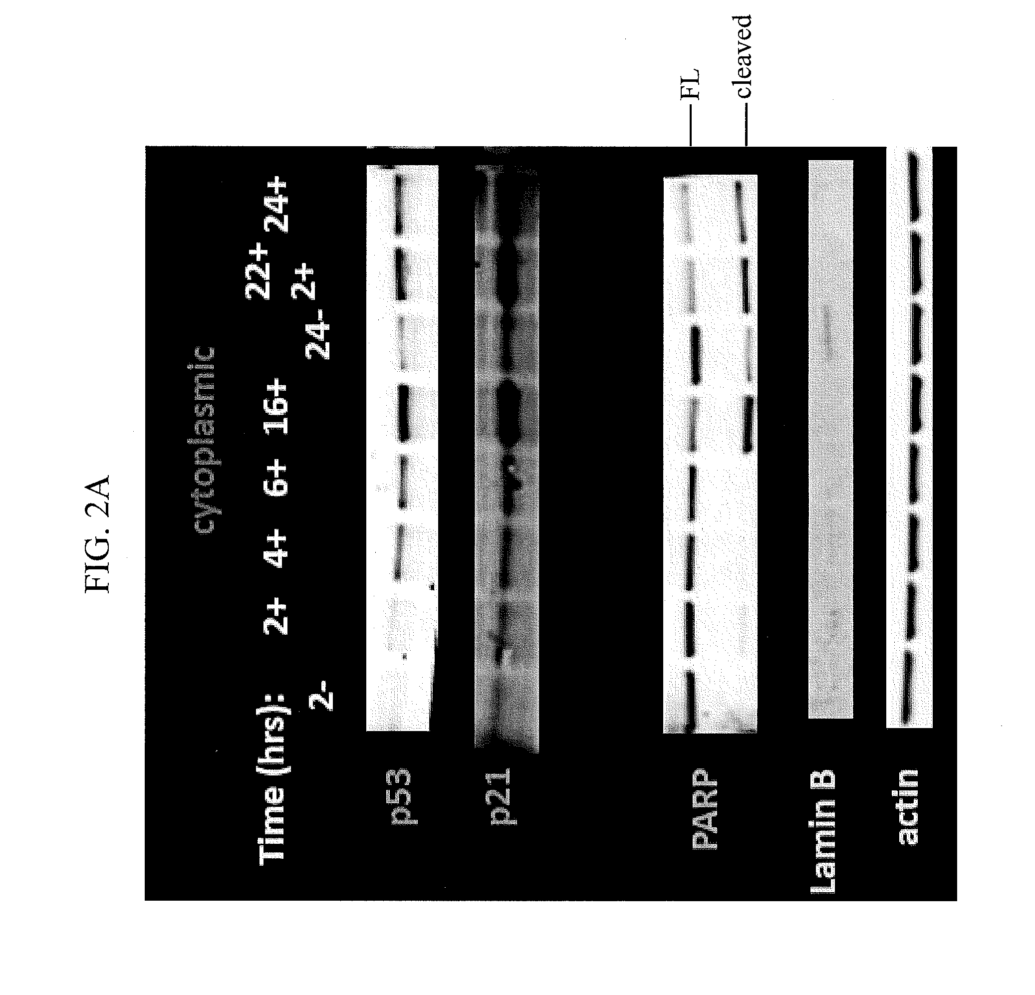 Nuclear Transport Modulators and Uses Thereof