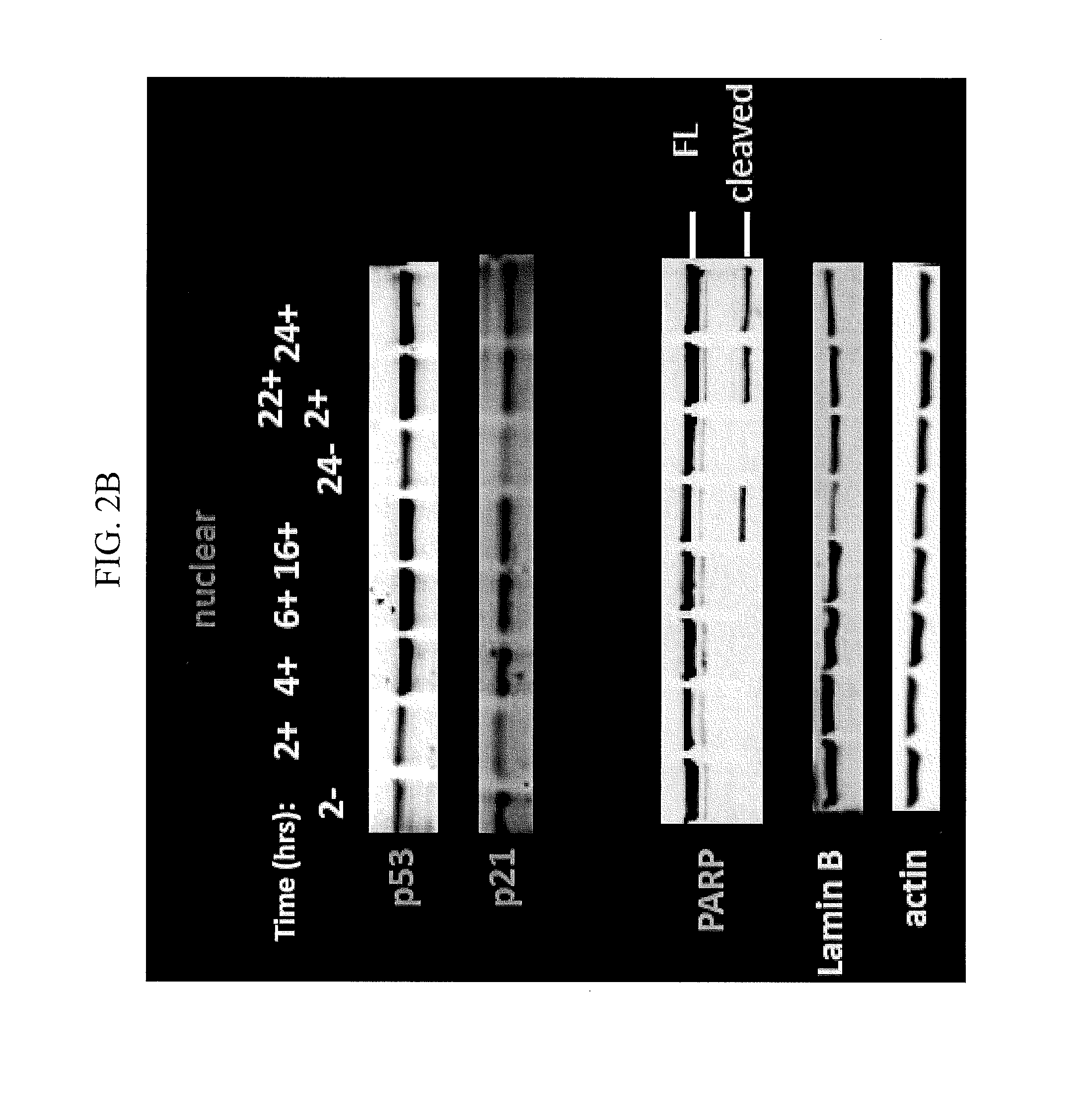 Nuclear Transport Modulators and Uses Thereof