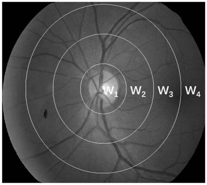 High-precision fundus blood vessel extraction method, device, medium, equipment and system