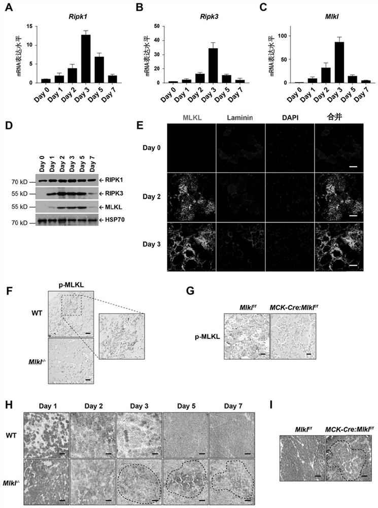 Method for inducing muscle stem cell expansion