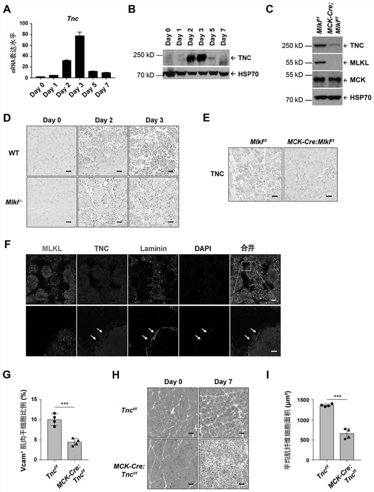 Method for inducing muscle stem cell expansion