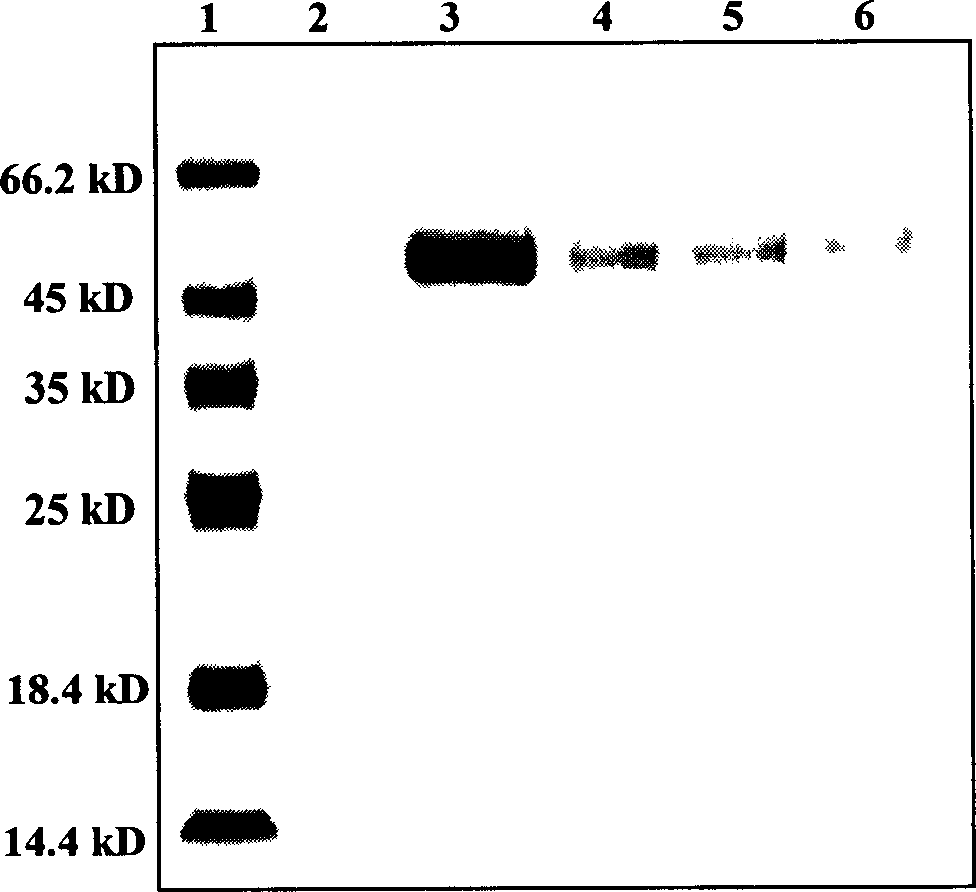 Beta-mannase, its expression and special engineering bacterium