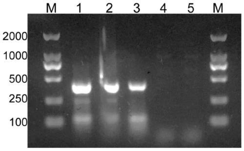 Technical method for identifying human mycobacterium tuberculosis, mycobacterium bovis and bacillus calmette-guerin (BCG)