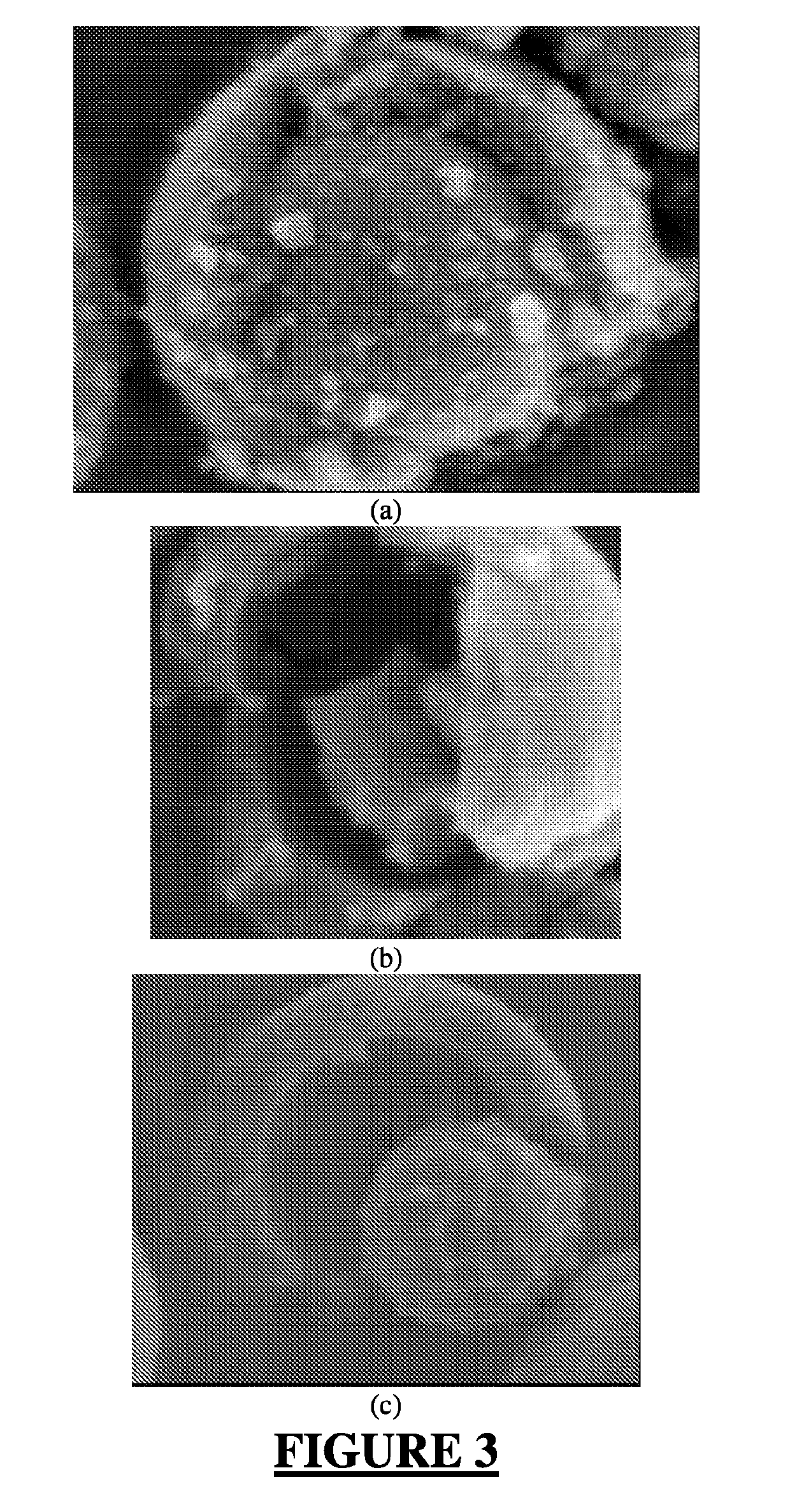 Hybrid material for chromatographic separations comprising a superficially porous core and a surrounding material