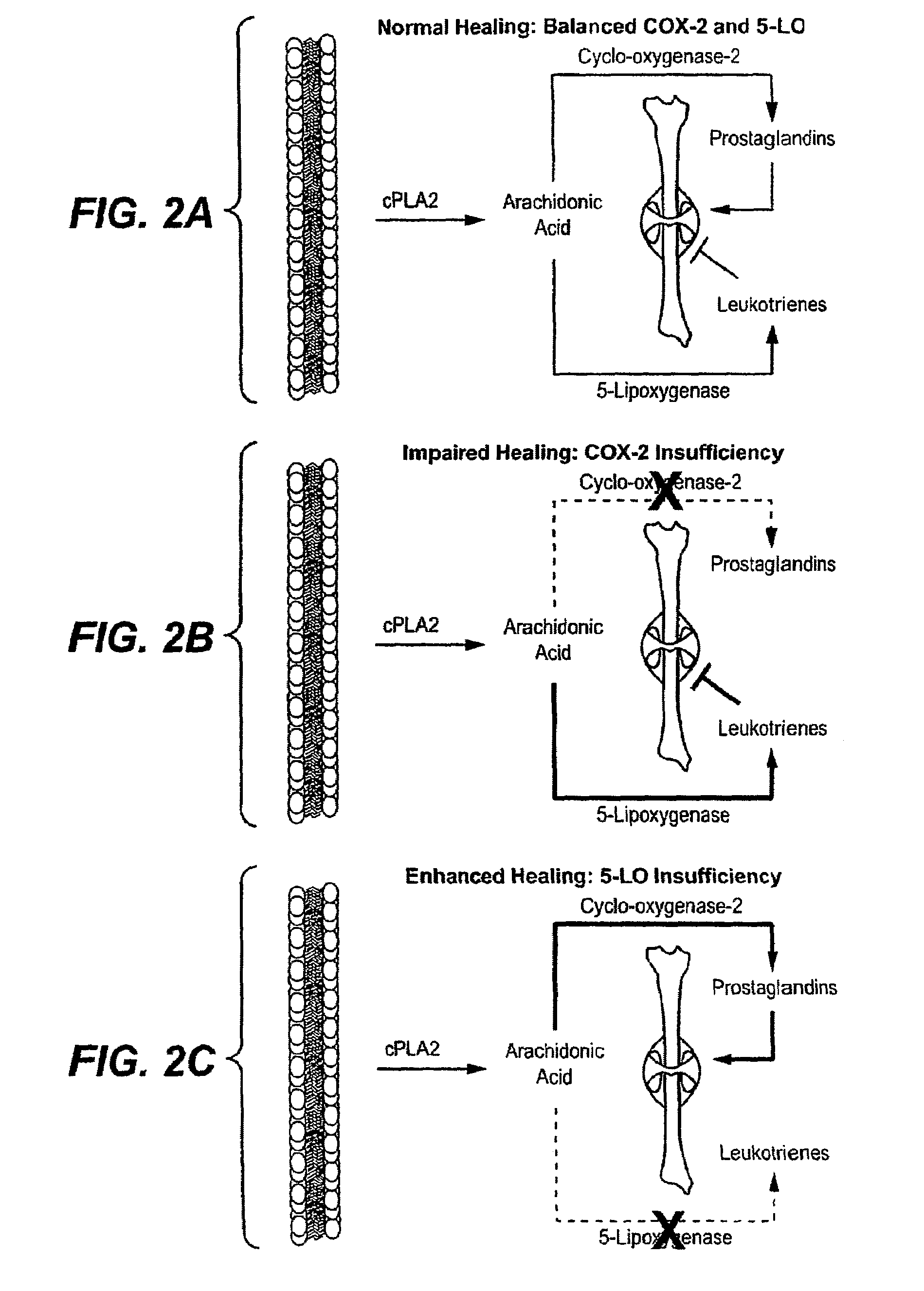 Methods for bone treatment by modulating an arachidonic acid metabolic or signaling pathway