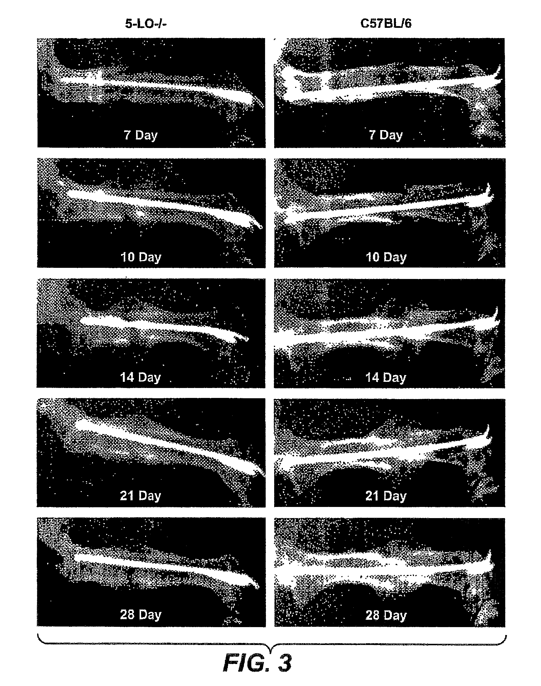 Methods for bone treatment by modulating an arachidonic acid metabolic or signaling pathway