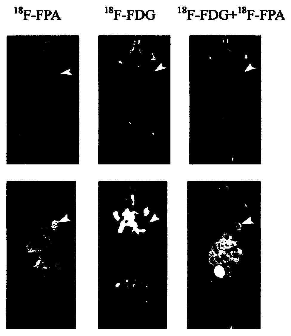 Radioactive composition, method for its single radiosynthesis and use thereof