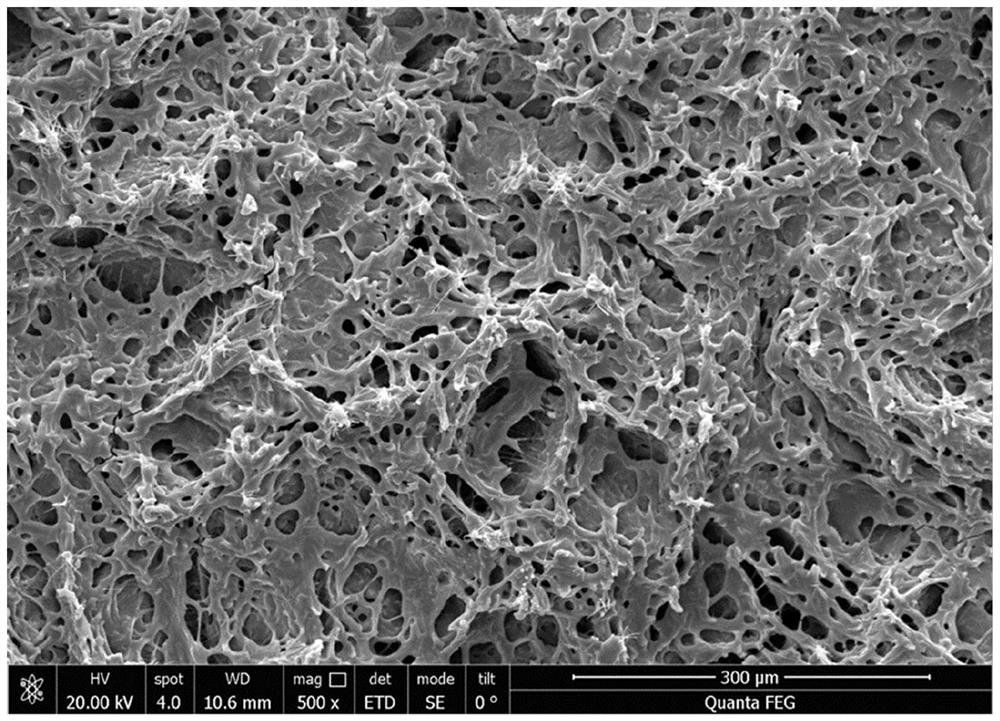 Antibacterial hydrogel loaded with pH response type microcarrier as well as preparation method and application of antibacterial hydrogel