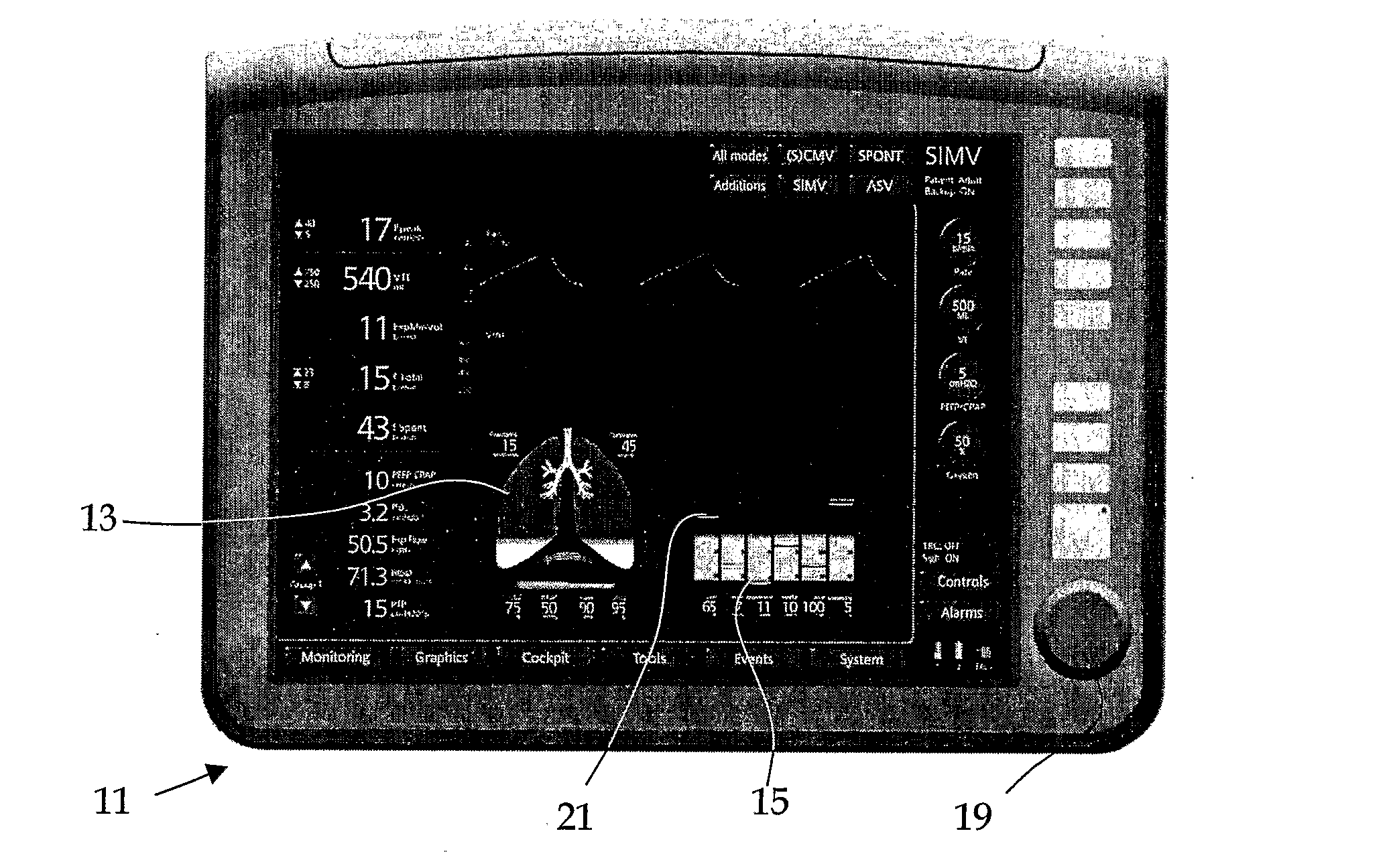 Method and a device for simplifying a diagnostic assessment of a mechanically ventilated patient