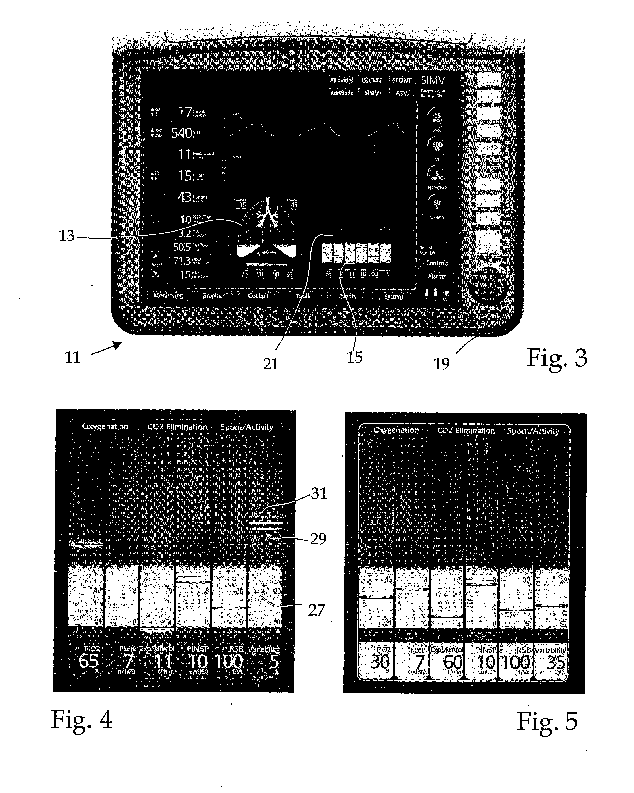 Method and a device for simplifying a diagnostic assessment of a mechanically ventilated patient
