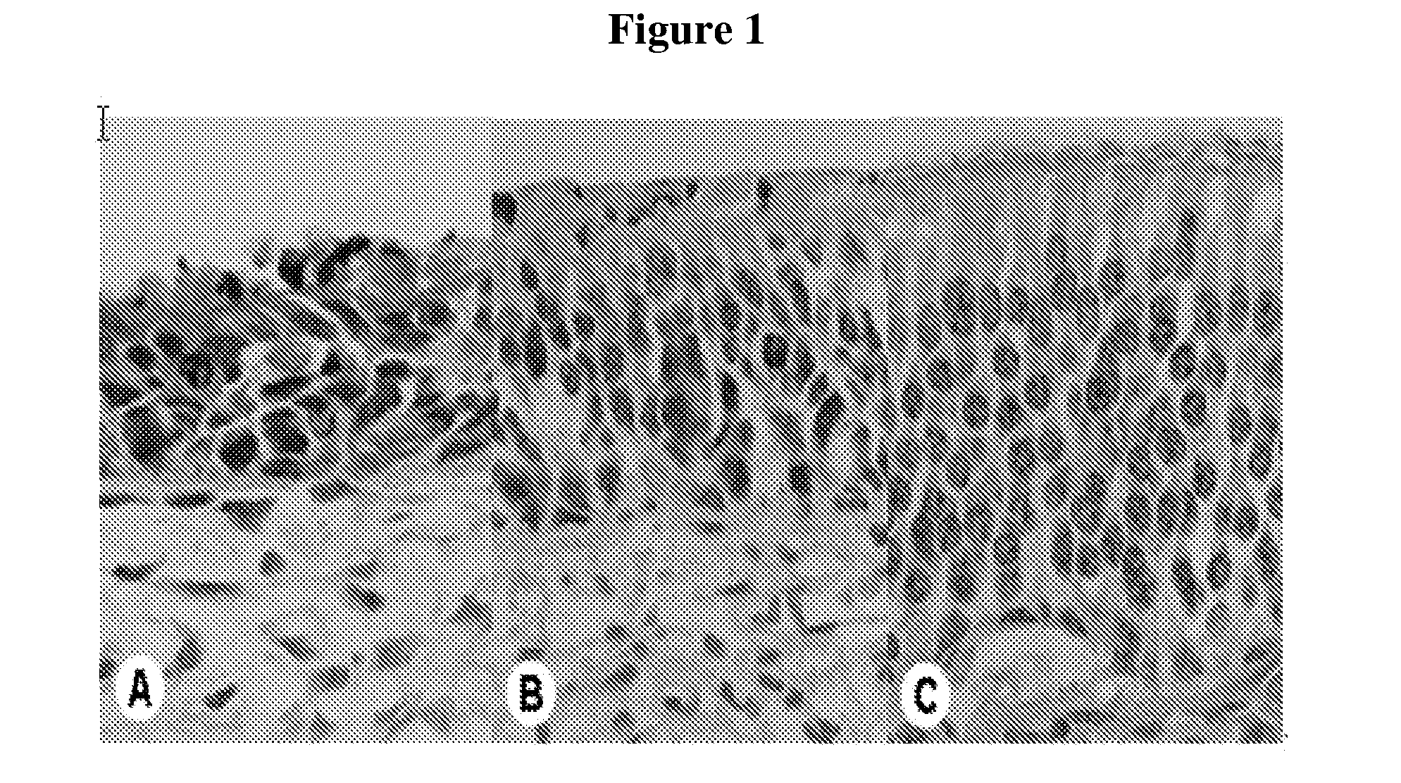 Method for treating olfactory disorder