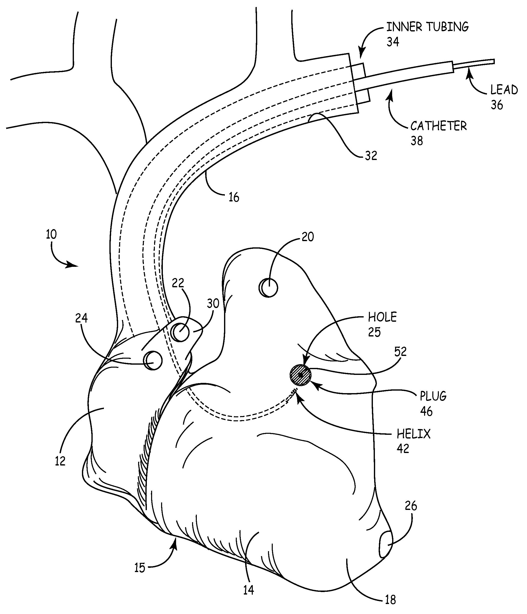 Heart model