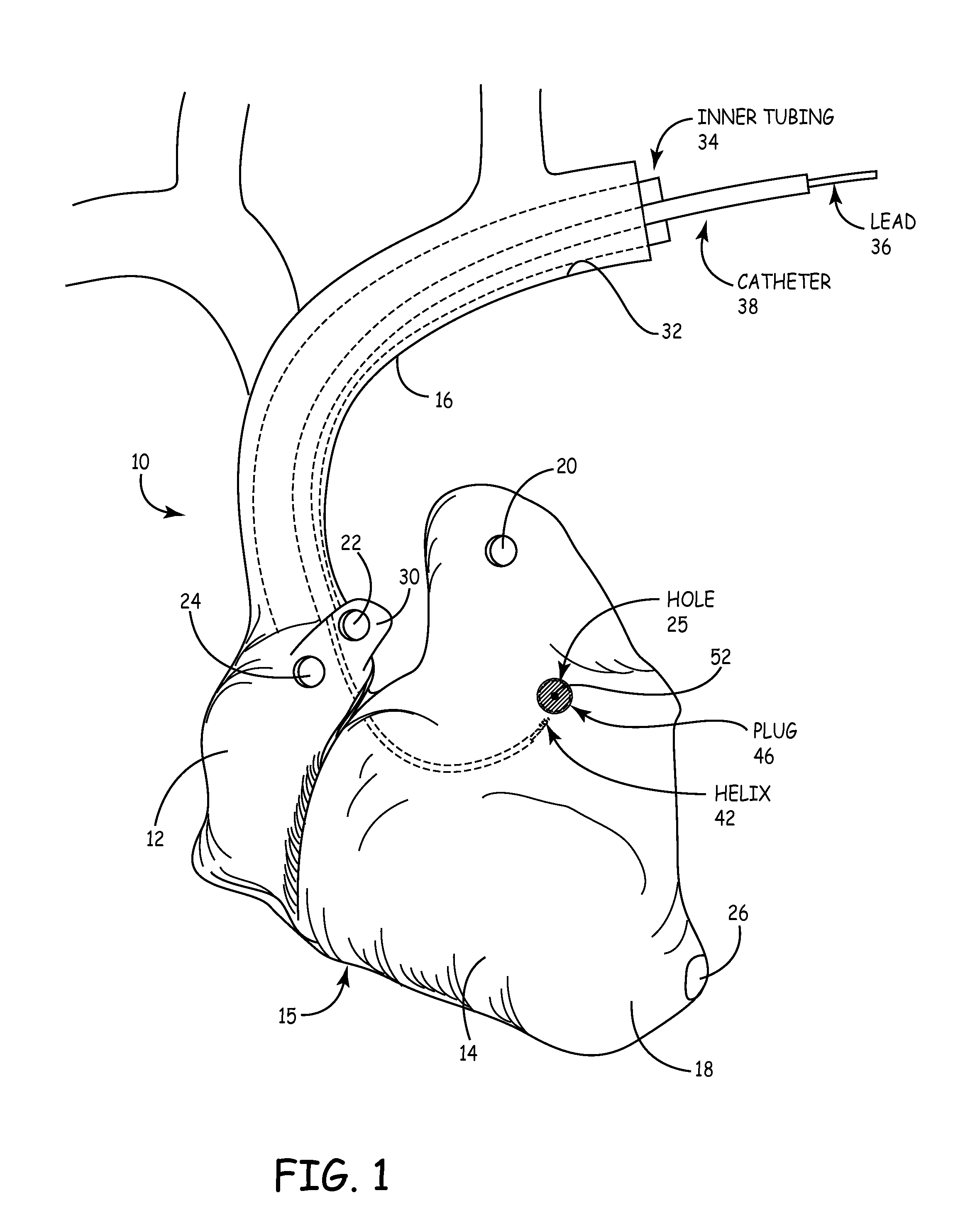 Heart model