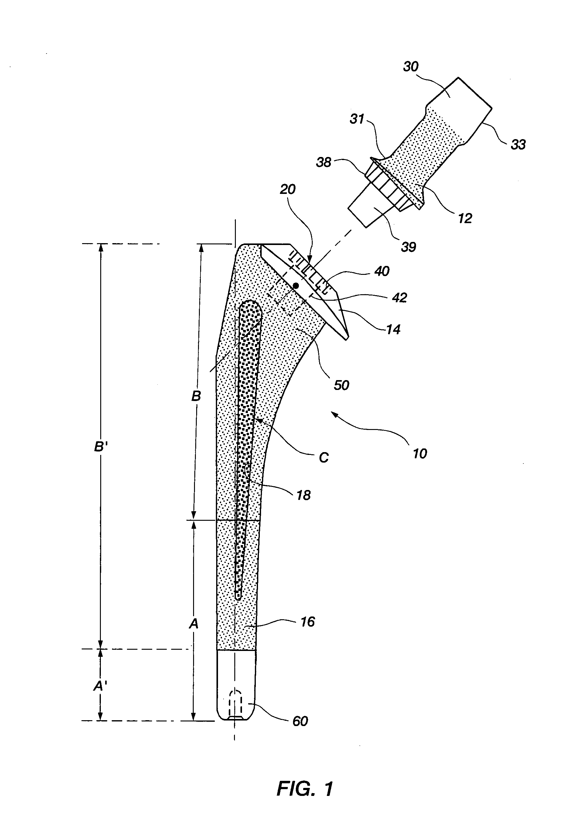 Differential porosity prosthetic hip system