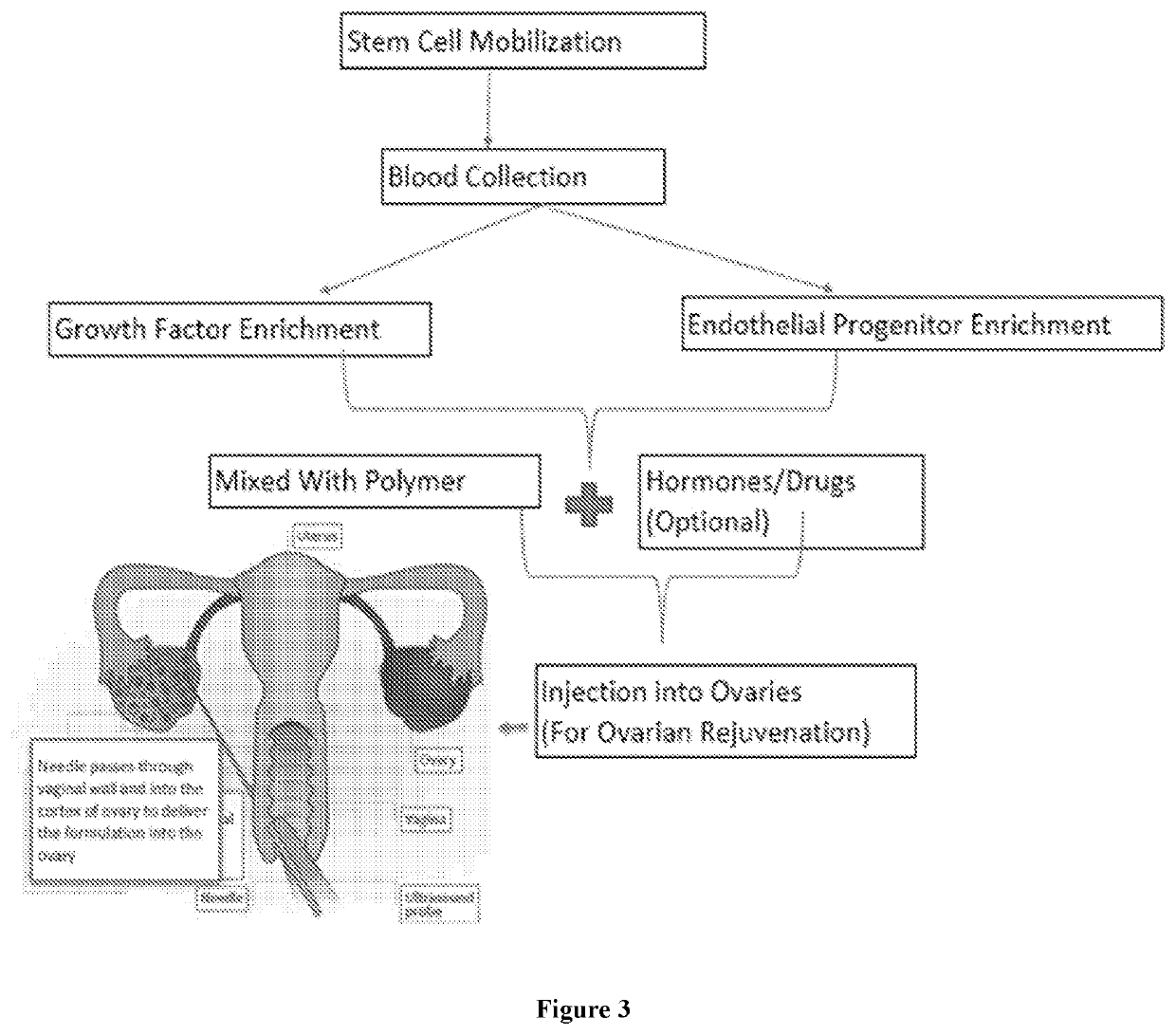 Compositions and methods for managing female infertility